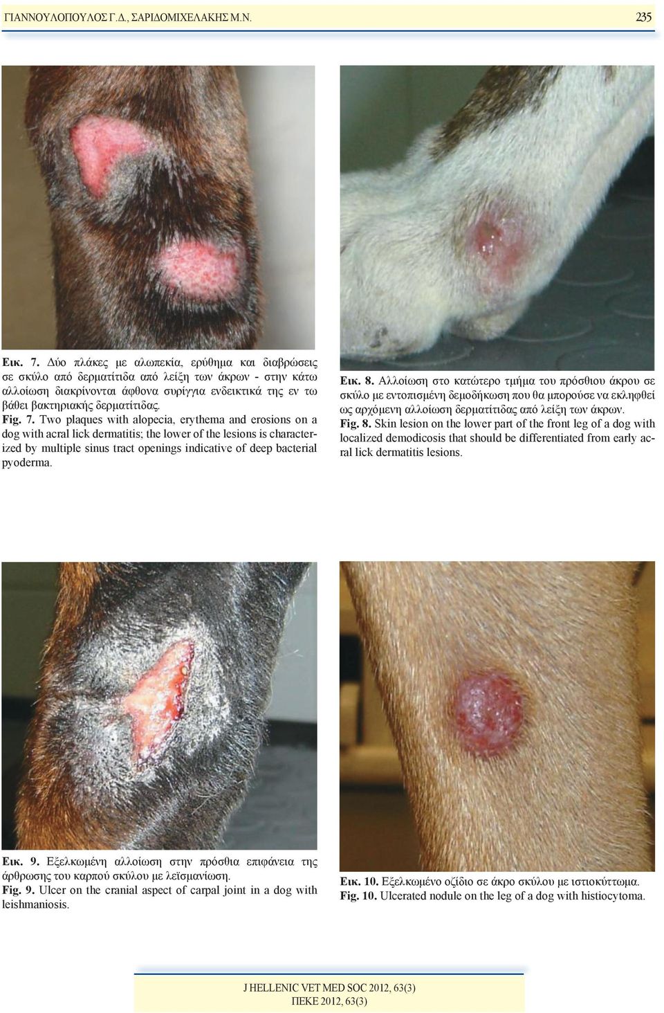 7. Two plaques with alopecia, erythema and erosions on a dog with acral lick dermatitis; the lower of the lesions is characterized by multiple sinus tract openings indicative of deep bacterial