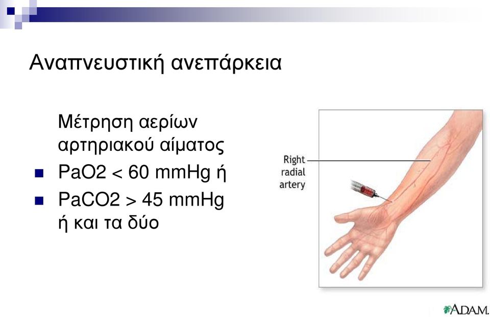 αίματος PaO2 < 60 mmhg ή