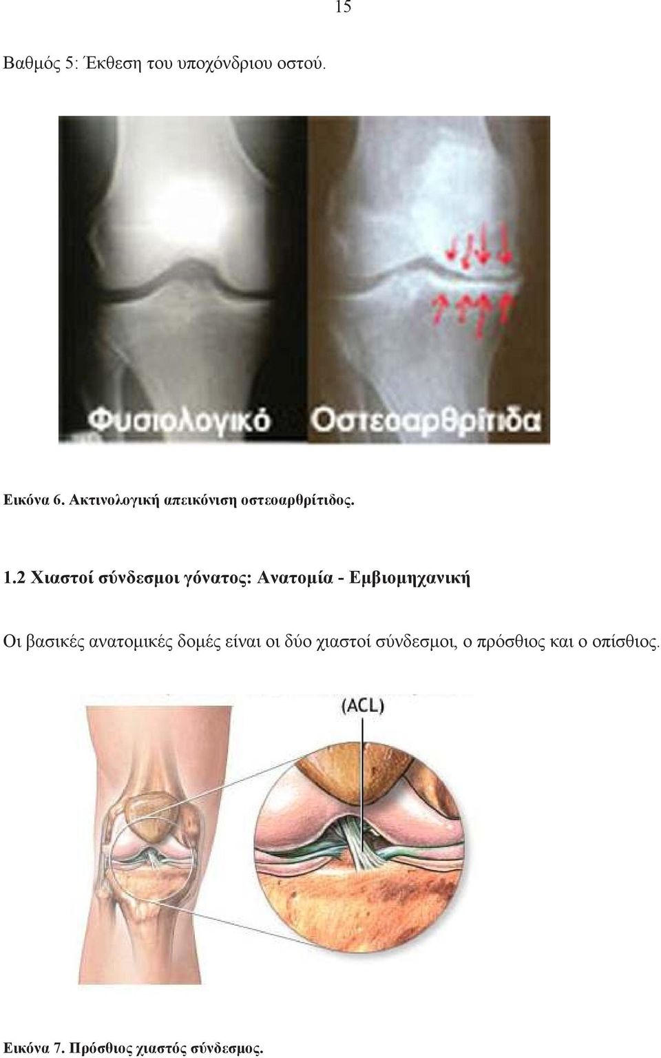2 Χιαστοί σύνδεσµοι γόνατος: Ανατοµία - Εµβιοµηχανική Οι βασικές