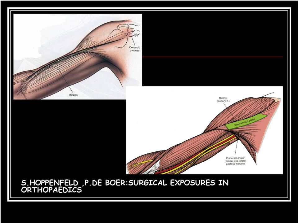 BOER:SURGICAL