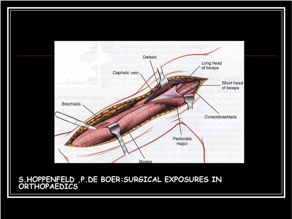 BOER:SURGICAL