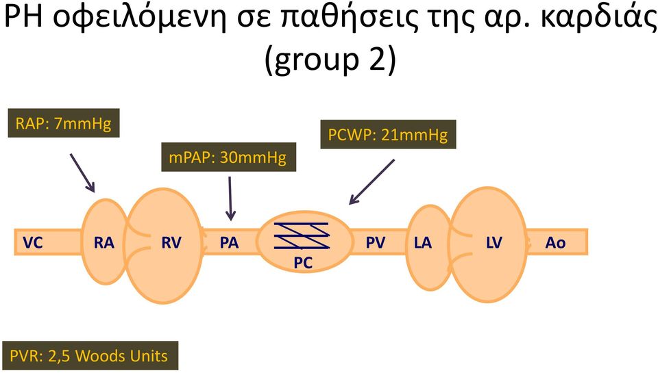 mpap: 30mmHg PCWP: 21mmHg VC RA