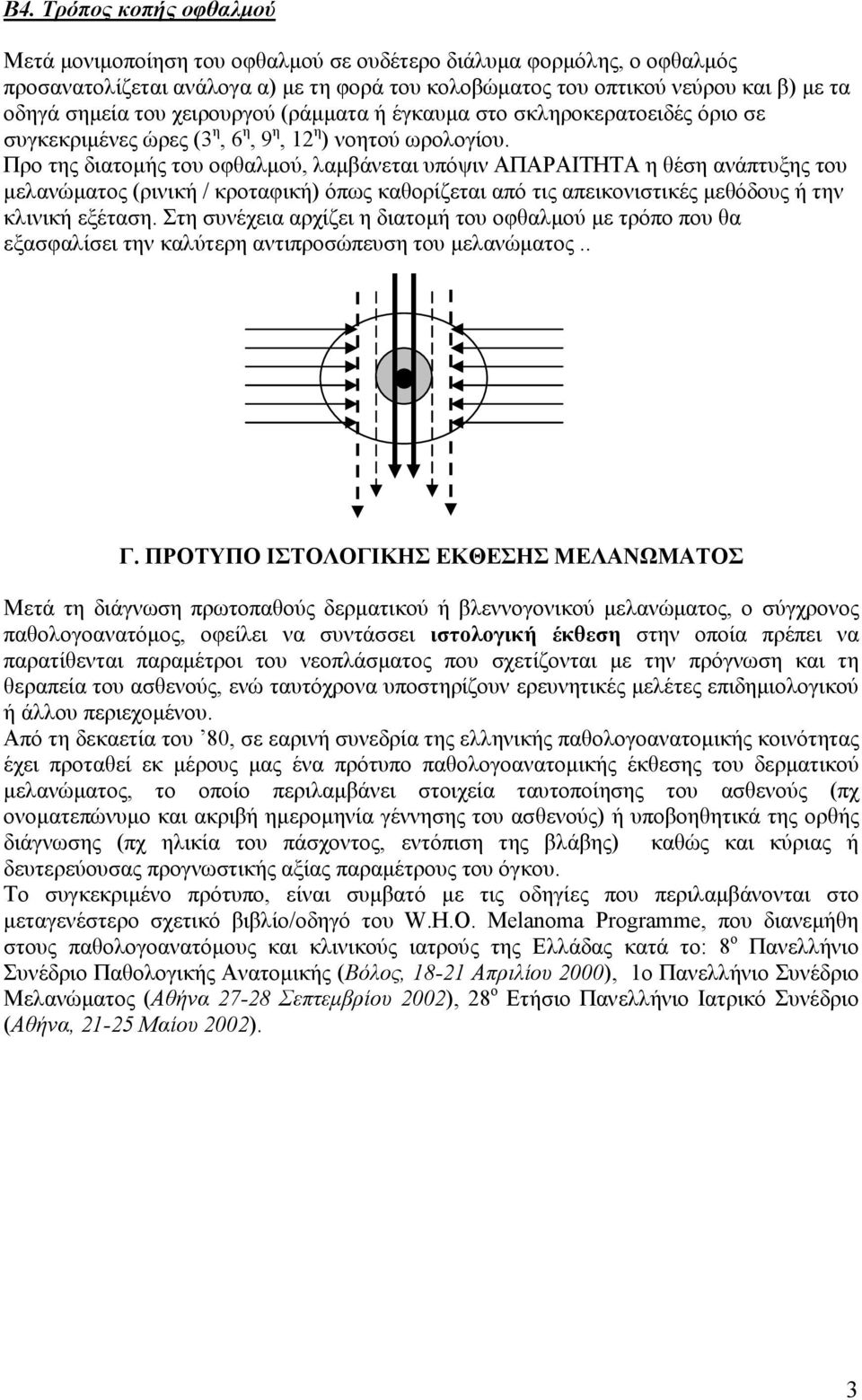 Προ της διατοµής του οφθαλµού, λαµβάνεται υπόψιν ΑΠΑΡΑΙΤΗΤΑ η θέση ανάπτυξης του µελανώµατος (ρινική / κροταφική) όπως καθορίζεται από τις απεικονιστικές µεθόδους ή την κλινική εξέταση.