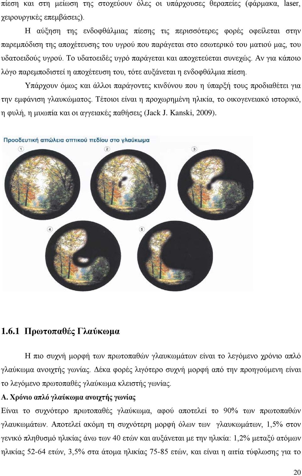 Το υδατοειδές υγρό παράγεται και αποχετεύεται συνεχώς. Αν για κάποιο λόγο παρεμποδιστεί η αποχέτευση του, τότε αυξάνεται η ενδοφθάλμια πίεση.