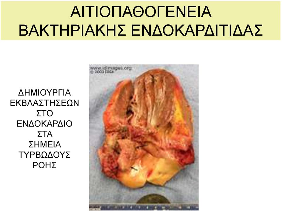 ΔΗΜΙΟΥΡΓΙΑ ΕΚΒΛΑΣΤΗΣΕΩΝ