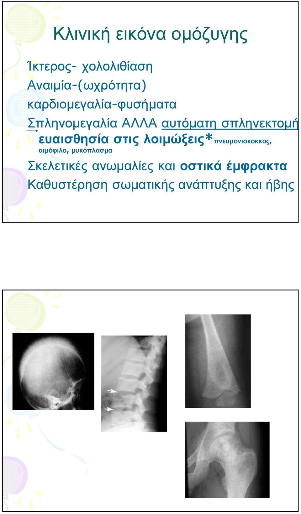 ευαισθησία στις λοιµώξεις*πνευµονιοκοκκος, αιµόφιλο, µυκόπλασµα