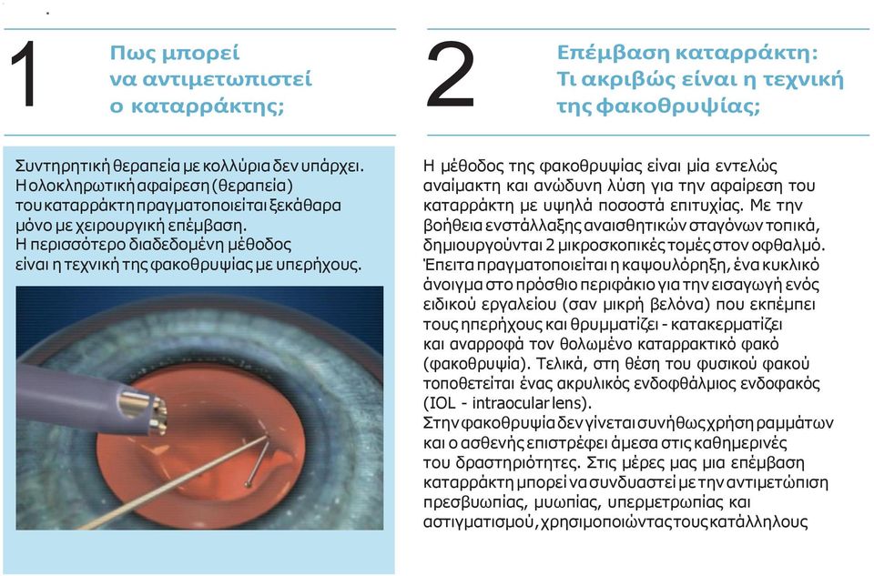 Η μέθοδος της φακοθρυψίας είναι μία εντελώς αναίμακτη και ανώδυνη λύση για την αφαίρεση του καταρράκτη με υψηλά ποσοστά επιτυχίας.