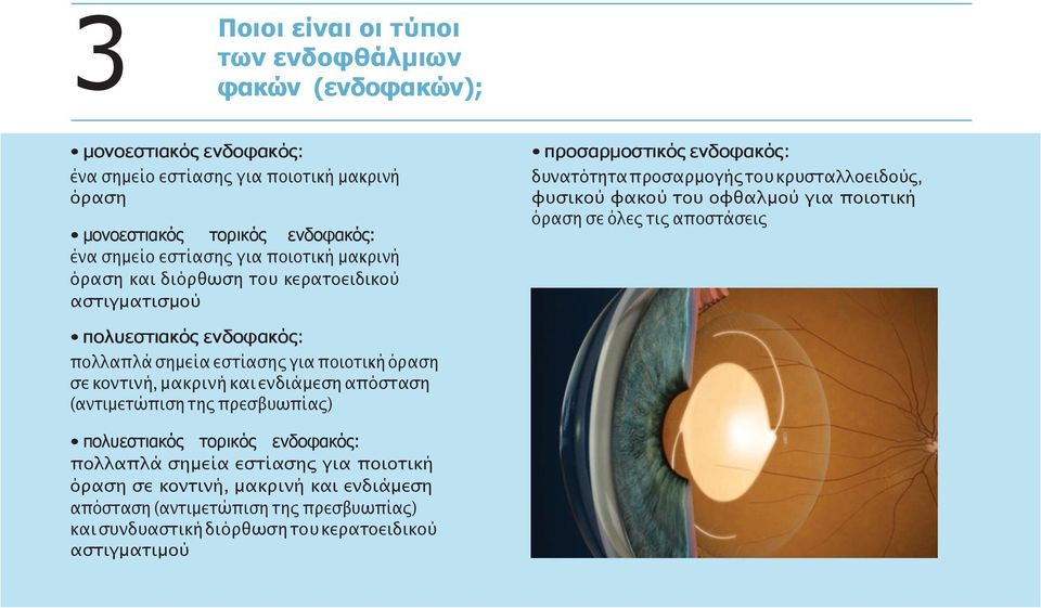 όραση σε όλες τις αποστάσεις πολυεστιακός ενδοφακός: πολλαπλά σημεία εστίασης για ποιοτική όραση σε κοντινή, μακρινή και ενδιάμεση απόσταση (αντιμετώπιση της πρεσβυωπίας) πολυεστιακός