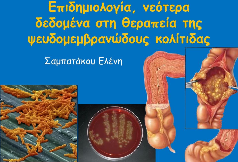 της ψευδομεμβρανώδους