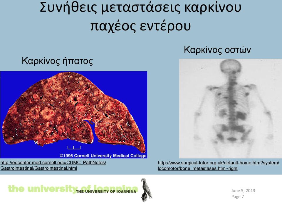 edu/cumc_pathnotes/ Gastrointestinal/Gastrointestinal.