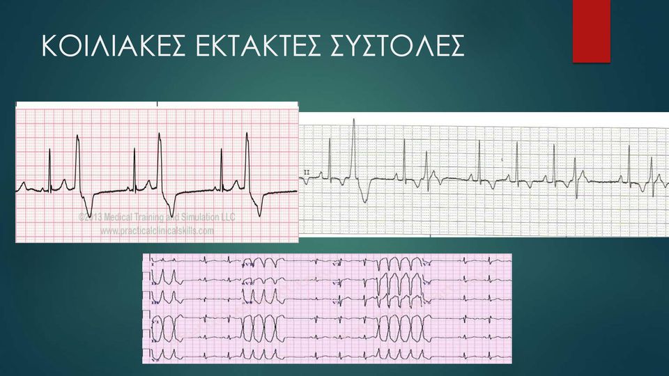 ΣΥΣΤΟΛΕΣ