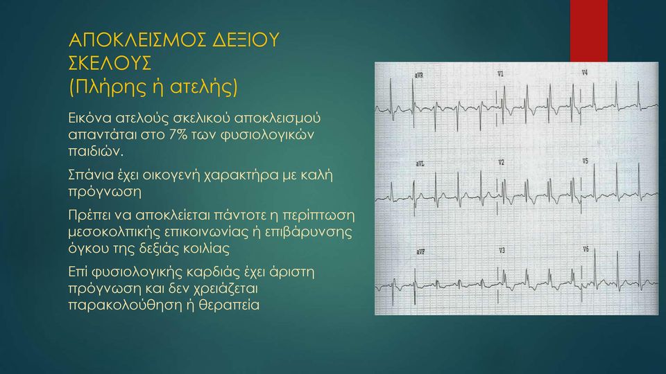 Σπάνια έχει οικογενή χαρακτήρα με καλή πρόγνωση Πρέπει να αποκλείεται πάντοτε η περίπτωση