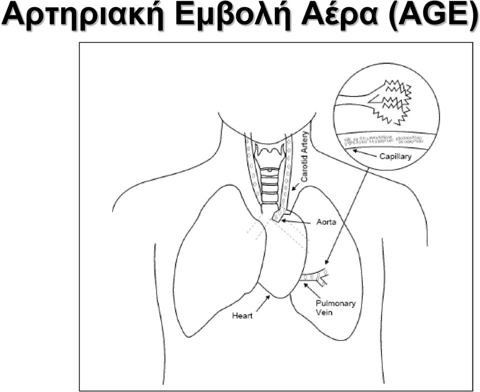 Αέρα