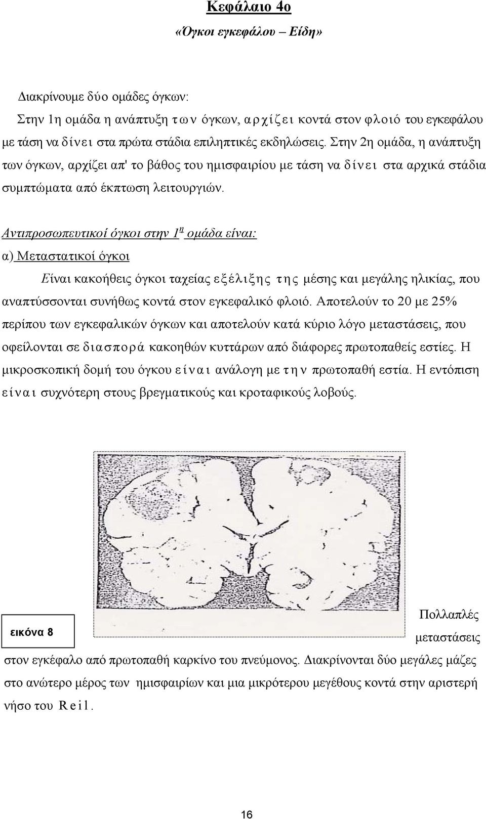 η Αντιπροσωπευτικοί όγκοι στην 1 ομάδα είναι: α) Μεταστατικοί όγκοι Είναι κακοήθεις όγκοι ταχείας εξέλιξης της μέσης και μεγάλης ηλικίας, που αναπτύσσονται συνήθως κοντά στον εγκεφαλικό φλοιό.