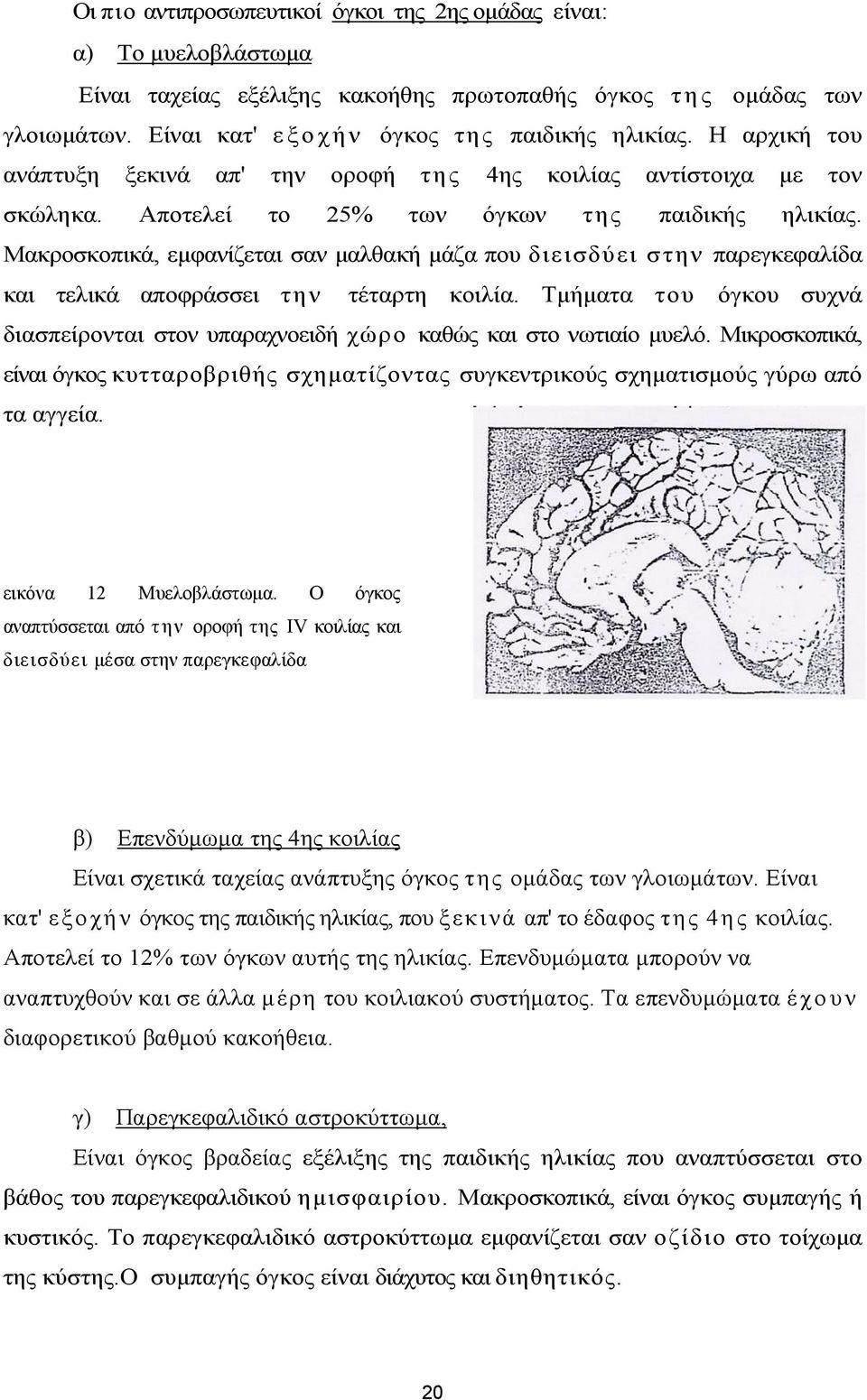 Μακροσκοπικά, εμφανίζεται σαν μαλθακή μάζα που διεισδύει στην παρεγκεφαλίδα και τελικά αποφράσσει την τέταρτη κοιλία.