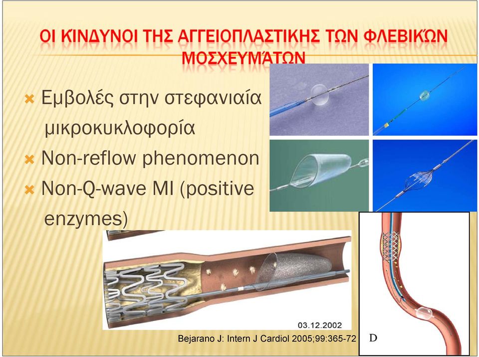 phenomenon Non-Q-wave MI (positive