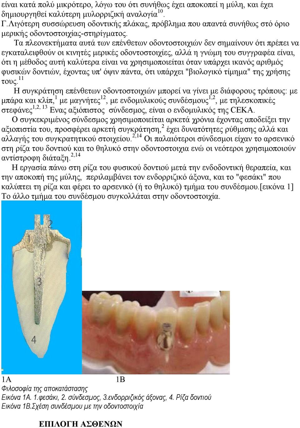 Τα πλεονεκτήµατα αυτά των επένθετων οδοντοστοιχιών δεν σηµαίνουν ότι πρέπει να εγκαταλειφθούν οι κινητές µερικές οδοντοστοιχίες, αλλά η γνώµη του συγγραφέα είναι, ότι η µέθοδος αυτή καλύτερα είναι να