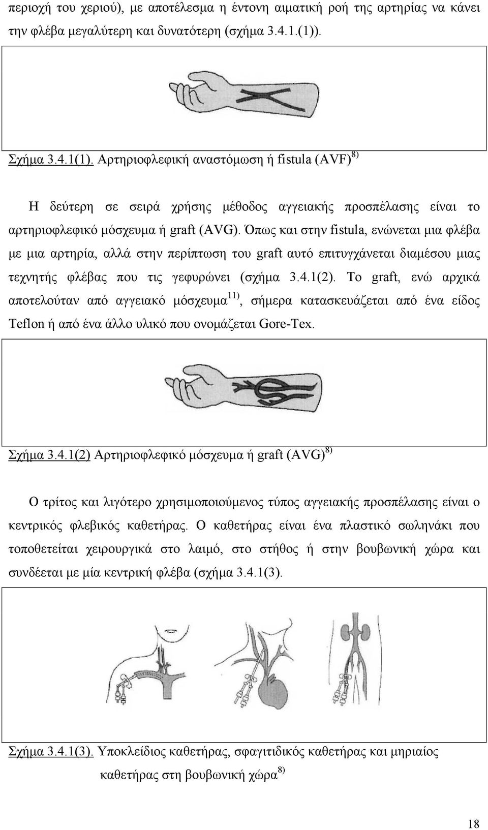 Όπως και στην fistula, ενώνεται μια φλέβα με μια αρτηρία, αλλά στην περίπτωση του graft αυτό επιτυγχάνεται διαμέσου μιας τεχνητής φλέβας που τις γεφυρώνει (σχήμα 3.4.1(2).