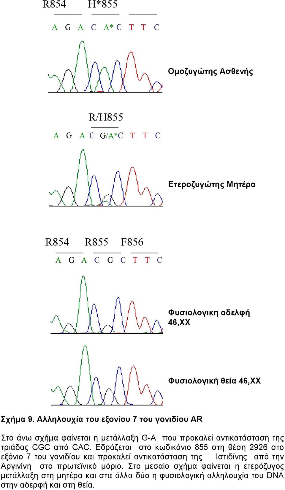 Αλληλουχία του εξονίου 7 του γονιδίου AR Στο άνω σχήµα φαίνεται η µετάλλαξη G-A που προκαλεί αντικατάσταση της τριάδας CGC από CΑC.