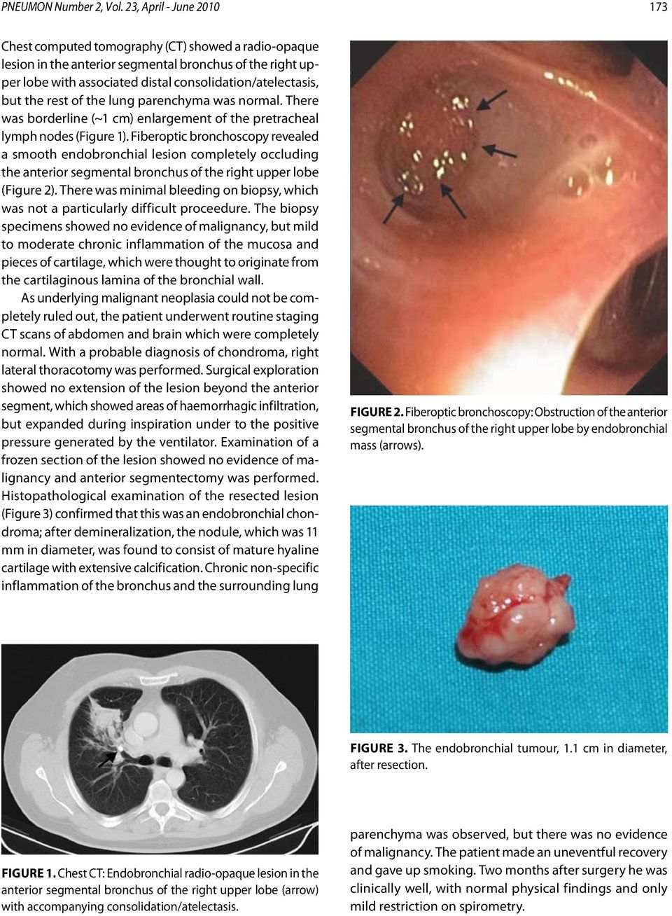 the rest of the lung parenchyma was normal. There was borderline (~1 cm) enlargement of the pretracheal lymph nodes (Figure 1).