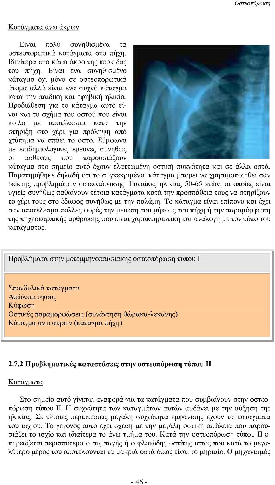 Προδιάθεση για το κάταγµα αυτό είναι και το σχήµα του οστού που είναι κοίλο µε αποτέλεσµα κατά την στήριξη στο χέρι για πρόληψη από χτύπηµα να σπάει το οστό.