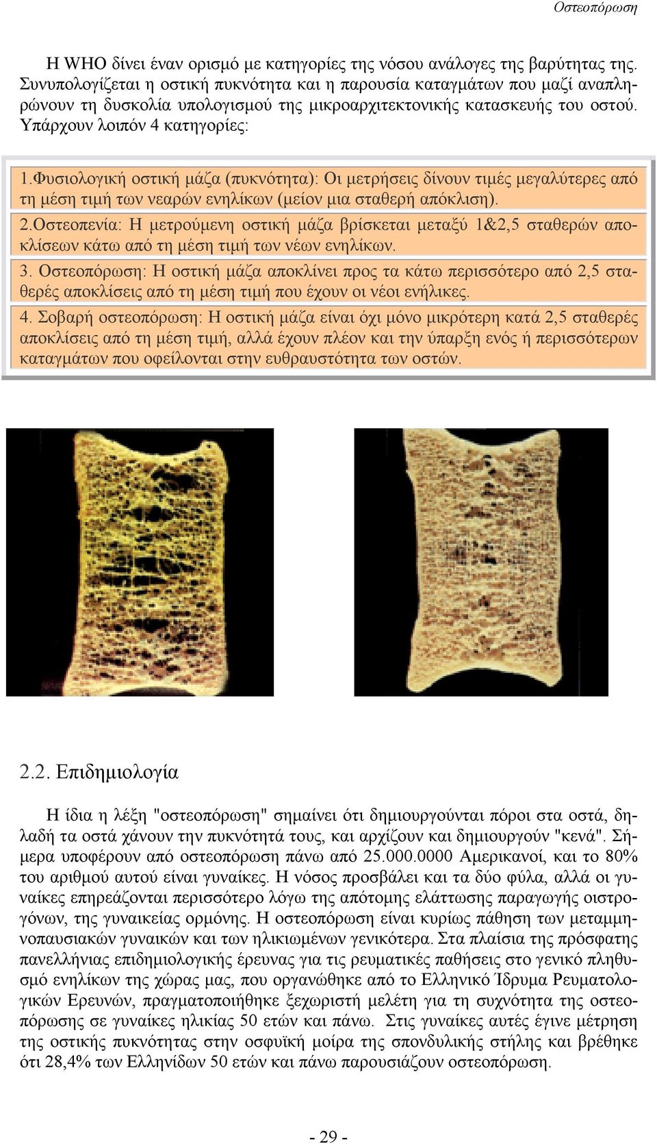 Φυσιολογική οστική µάζα (πυκνότητα): Οι µετρήσεις δίνουν τιµές µεγαλύτερες από τη µέση τιµή των νεαρών ενηλίκων (µείον µια σταθερή απόκλιση). 2.