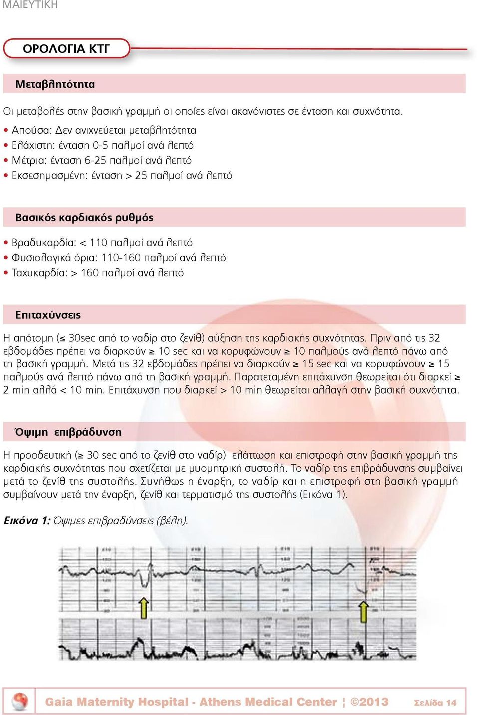 110 παλμοί ανά λεπτό Φυσιολογικά όρια: 110-160 παλμοί ανά λεπτό Ταχυκαρδία: > 160 παλμοί ανά λεπτό Επιταχύνσεις Η απότομη ( 30sec από το ναδίρ στο ζενίθ) αύξηση της καρδιακής συχνότητας.