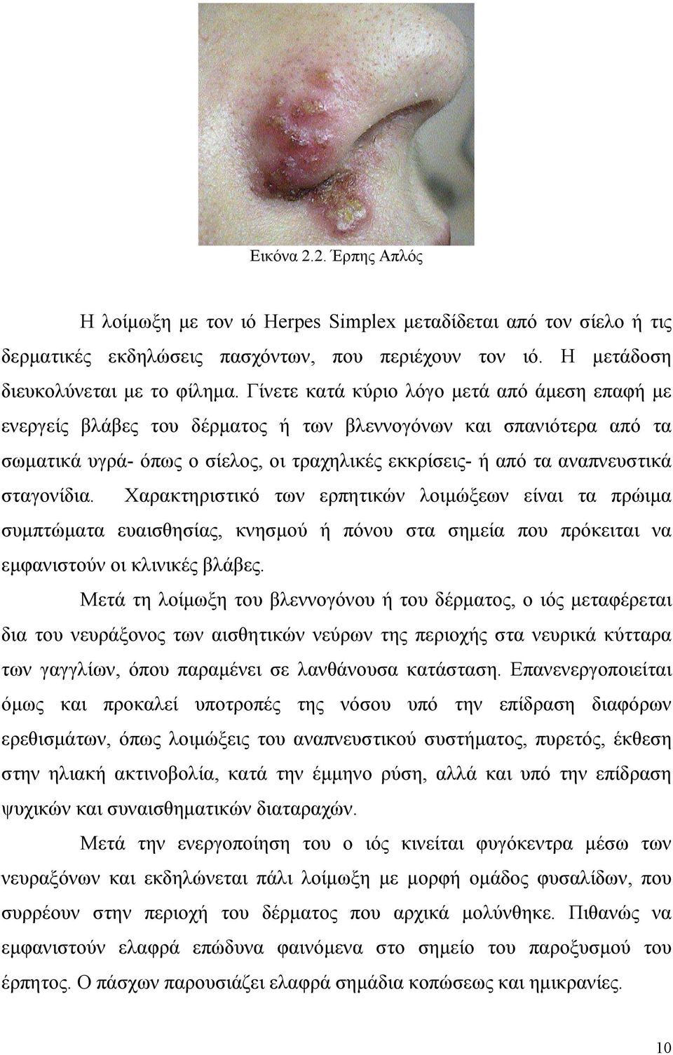 σταγονίδια. Χαρακτηριστικό των ερπητικών λοιµώξεων είναι τα πρώιµα συµπτώµατα ευαισθησίας, κνησµού ή πόνου στα σηµεία που πρόκειται να εµφανιστούν οι κλινικές βλάβες.