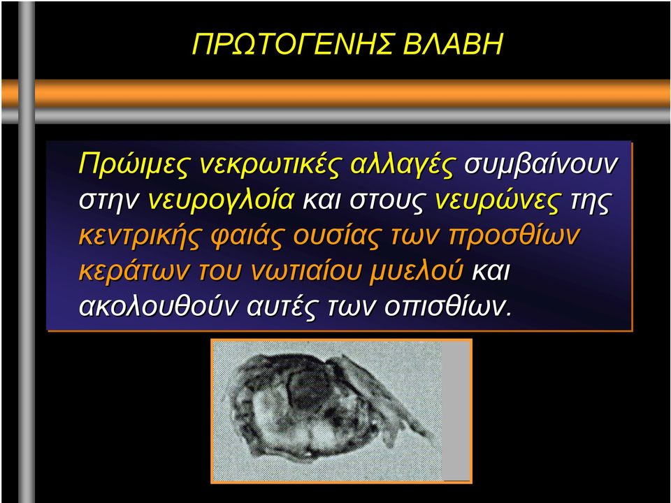 της κεντρικής φαιάς ουσίας των προσθίων κεράτων