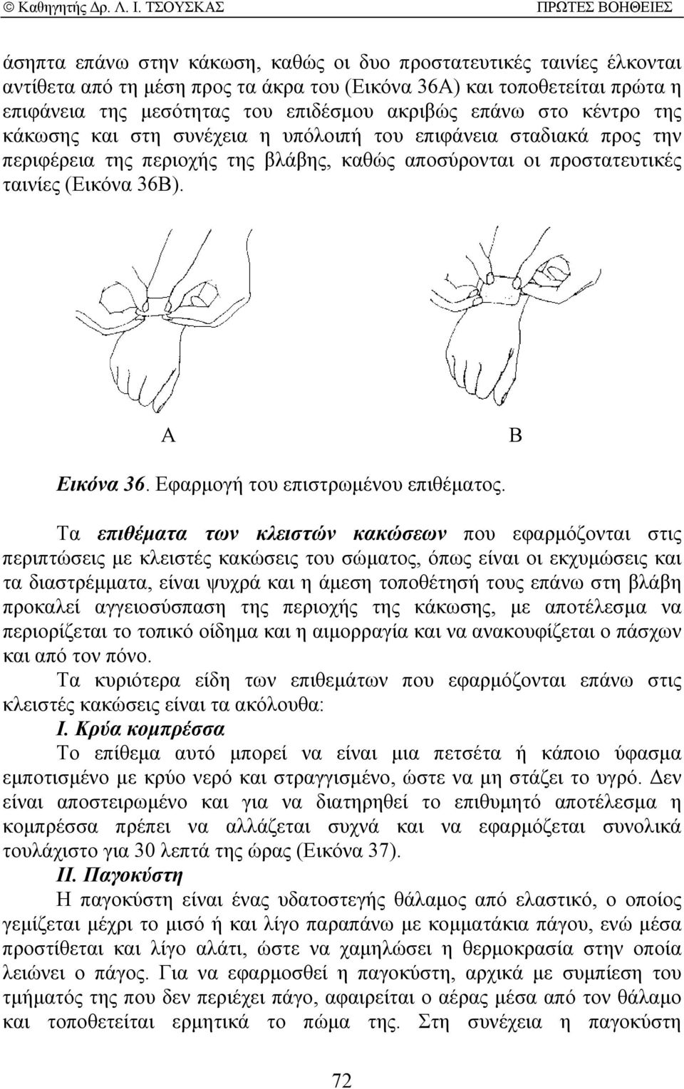 Εφαρµογή του επιστρωµένου επιθέµατος.