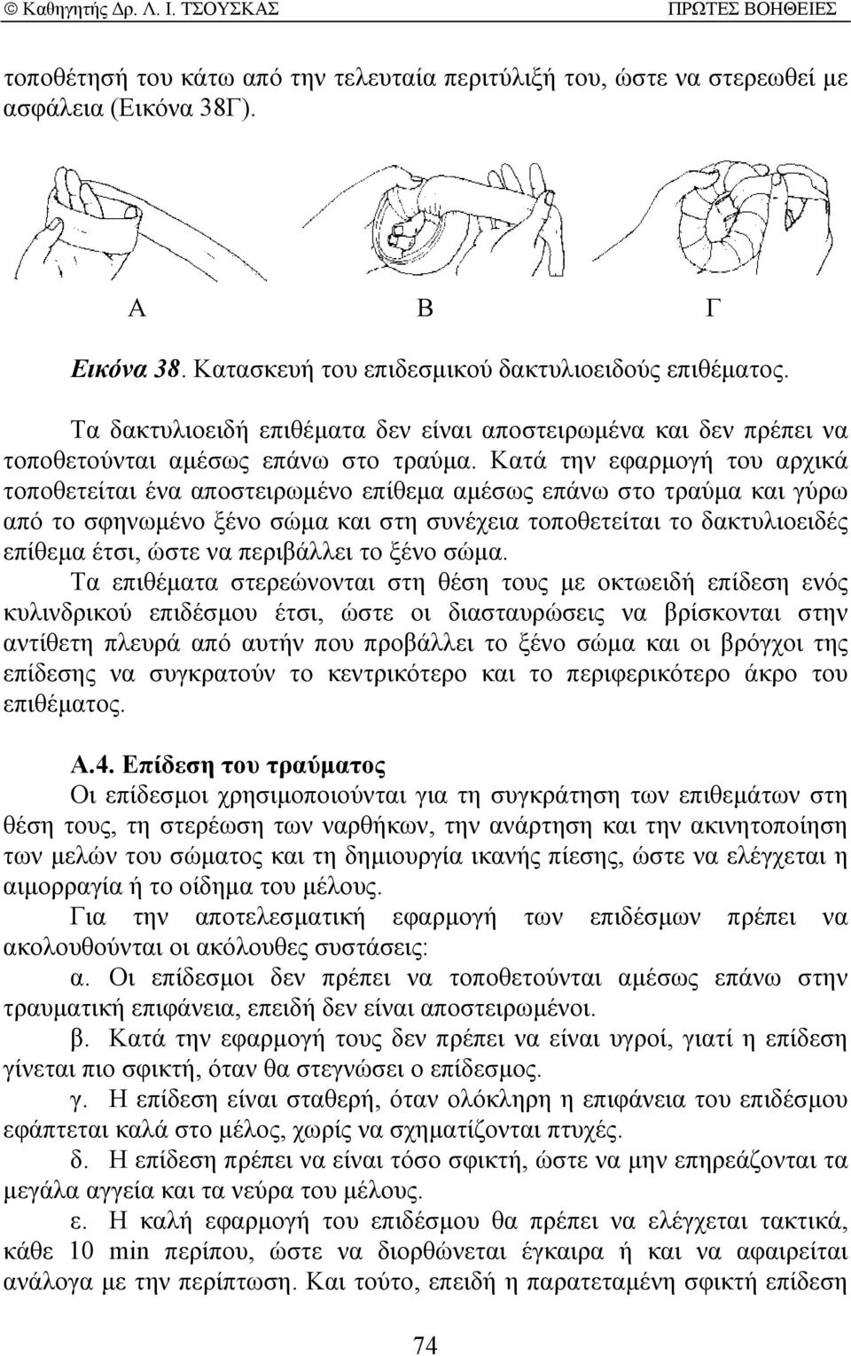 Κατά την εφαρµογή του αρχικά τοποθετείται ένα αποστειρωµένο επίθεµα αµέσως επάνω στο τραύµα και γύρω από το σφηνωµένο ξένο σώµα και στη συνέχεια τοποθετείται το δακτυλιοειδές επίθεµα έτσι, ώστε να