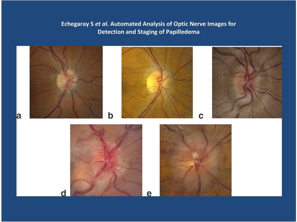 Optic Nerve Images for