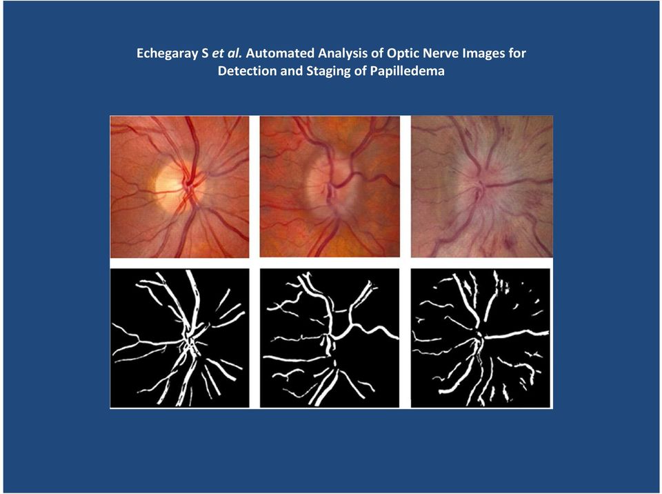 Optic Nerve Images for