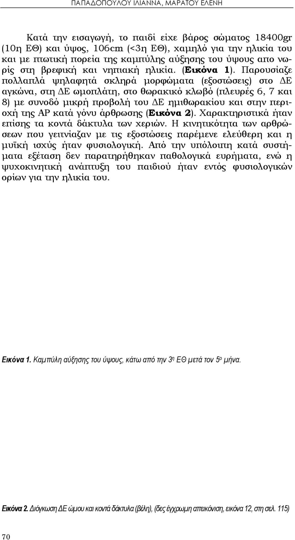 Παρουσίαζε πολλαπλά ψηλαφητά σκληρά μορφώματα (εξοστώσεις) στο ΔΕ αγκώνα, στη ΔΕ ωμοπλάτη, στο θωρακικό κλωβό (πλευρές 6, 7 και 8) με συνοδό μικρή προβολή του ΔΕ ημιθωρακίου και στην περιοχή της ΑΡ