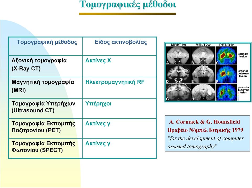 (PET) Τομογραφία Εκπομπής Φωτονίου (SPECT) Ακτίνες Χ Ηλεκτρομαγνητική RF Υπέρηχοι Ακτίνες γ