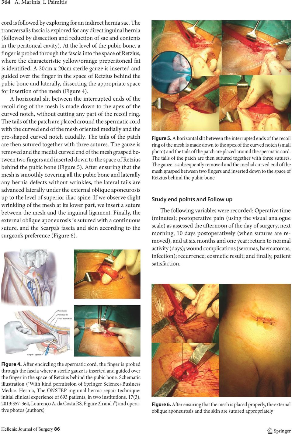 At the level of the pubic bone, a finger is probed through the fascia into the space of Retzius, where the characteristic yellow/orange preperitoneal fat is identified.