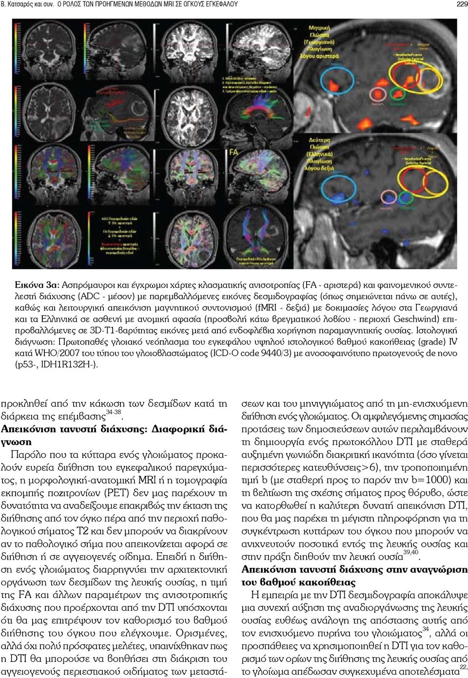 παρεμβαλλόμενες εικόνες δεσμιδογραφίας (όπως σημειώνεται πάνω σε αυτές), καθώς και λειτουργική απεικόνιση μαγνητικού συντονισμού (fmri - δεξιά) με δοκιμασίες λόγου στα Γεωργιανά και τα Ελληνικά σε