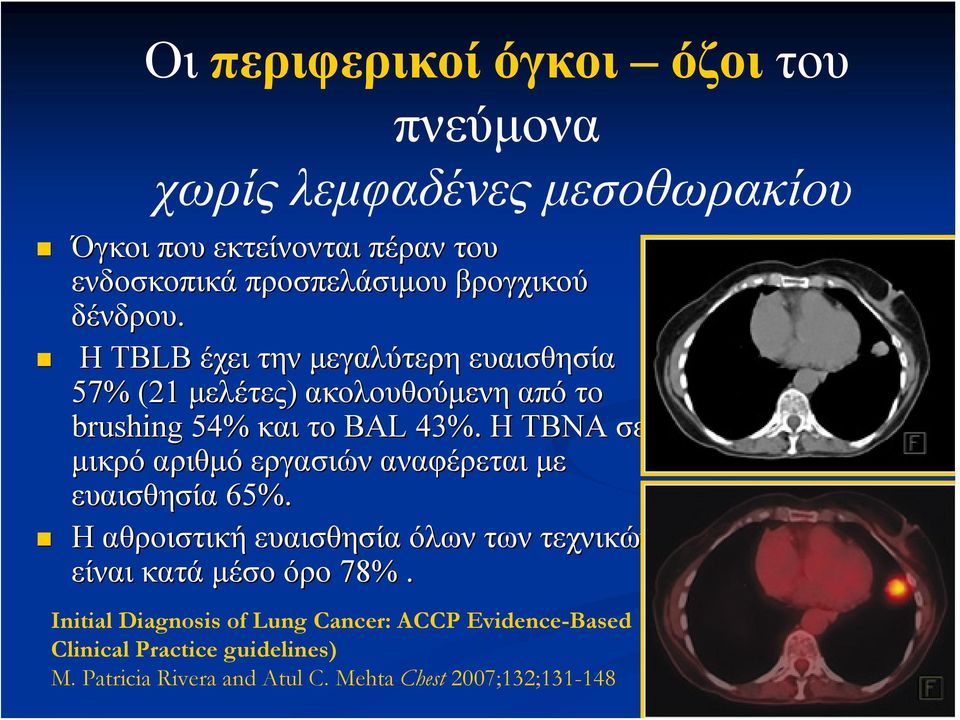 H TBNA σε μικρό αριθμό εργασιών αναφέρεται με ευαισθησία 65%. Η αθροιστική ευαισθησία όλων των τεχνικών είναι κατά μέσο όρο 78%.