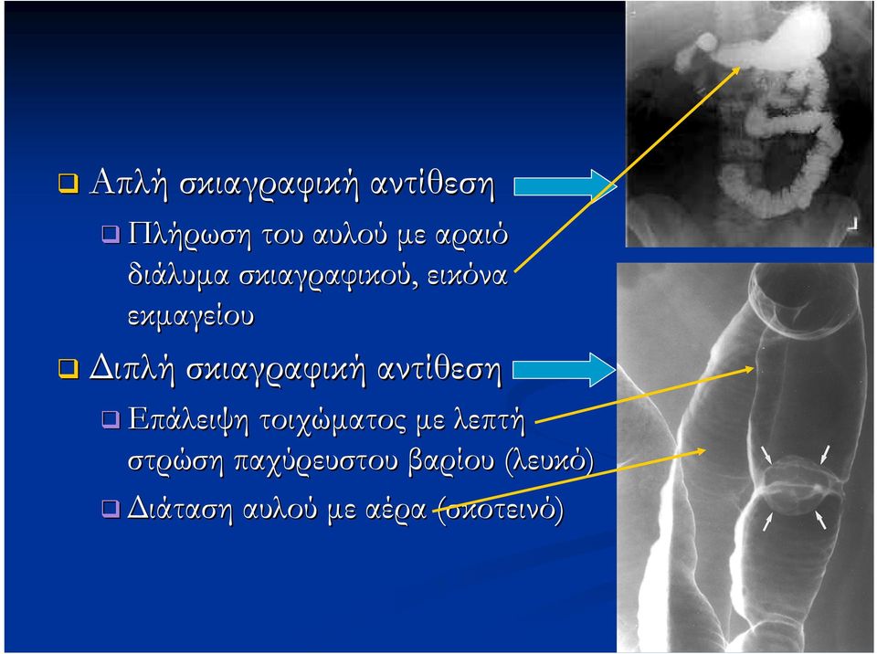 σκιαγραφική αντίθεση Επάλειψη τοιχώματος με λεπτή