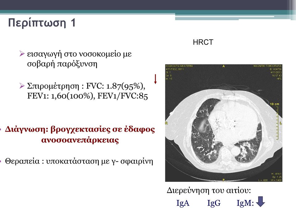 FVC: 1.