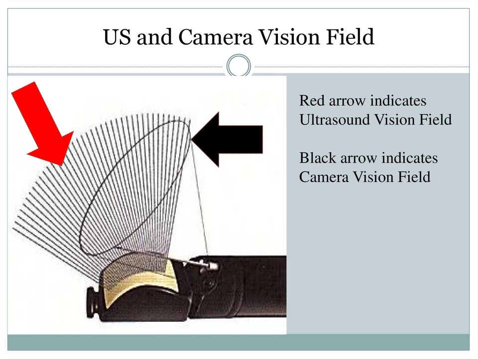 Ultrasound Vision Field