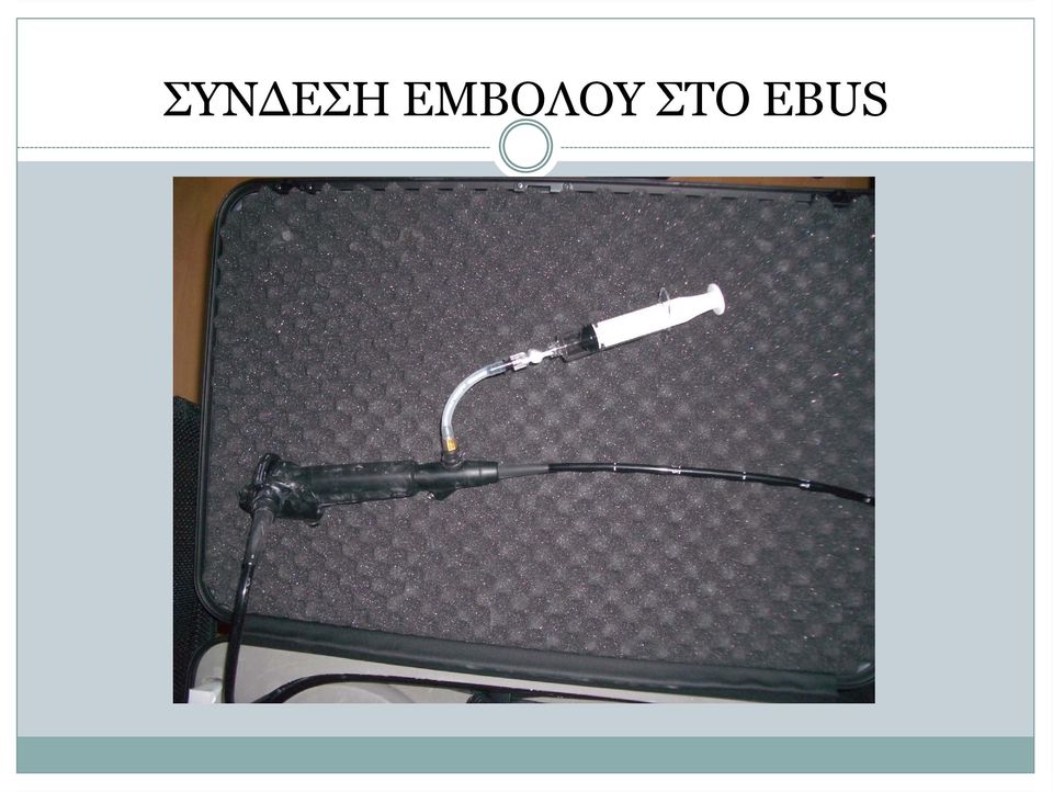 ΣΤΟ EBUS