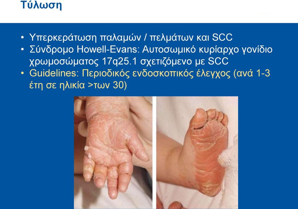 χρωμοσώματος 17q25.