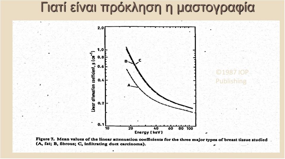 μαστογραφία