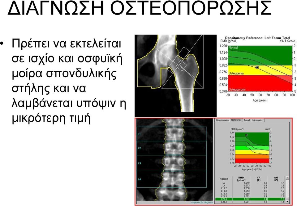 κνίξα ζπνλδπιηθήο ζηήιεο θαη λα