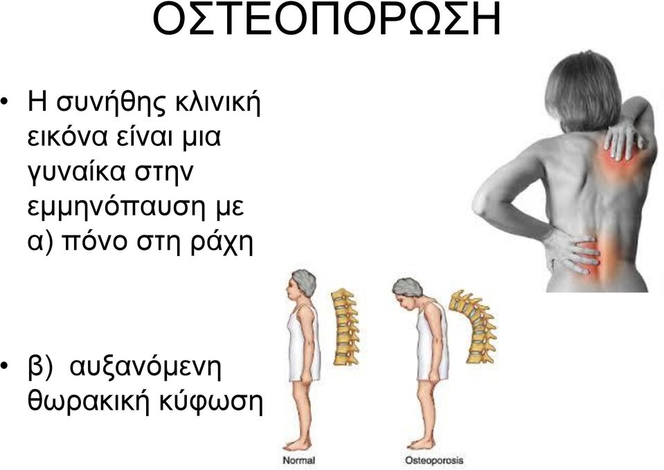 εκκελόπαπζε κε α) πόλν ζηε