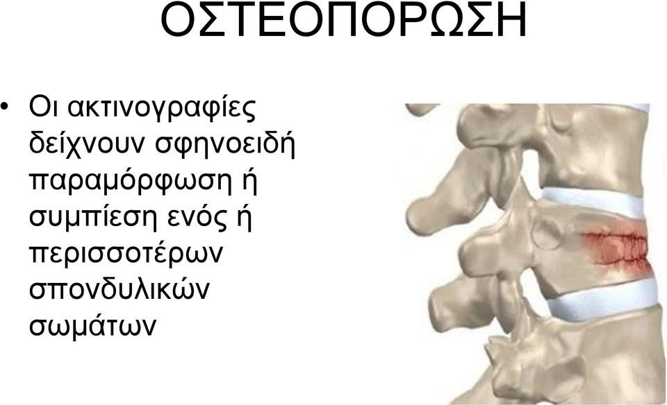 ζπκπίεζε ελόο ή