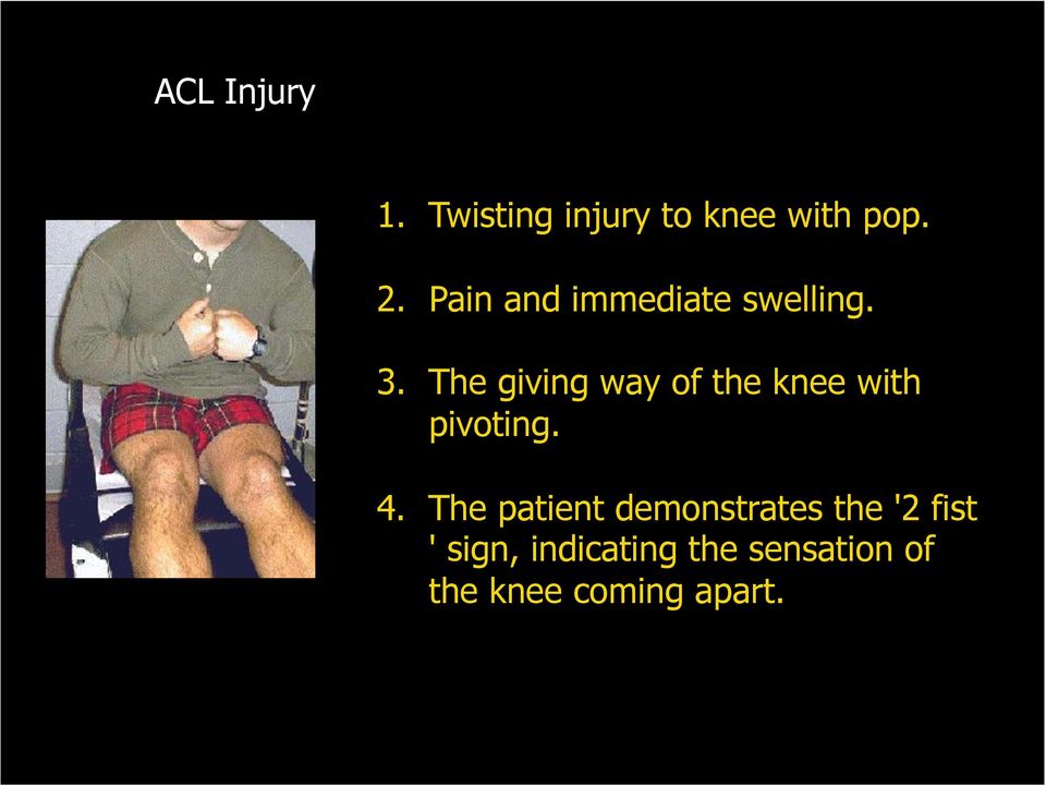 The giving way of the knee with pivoting. 4.