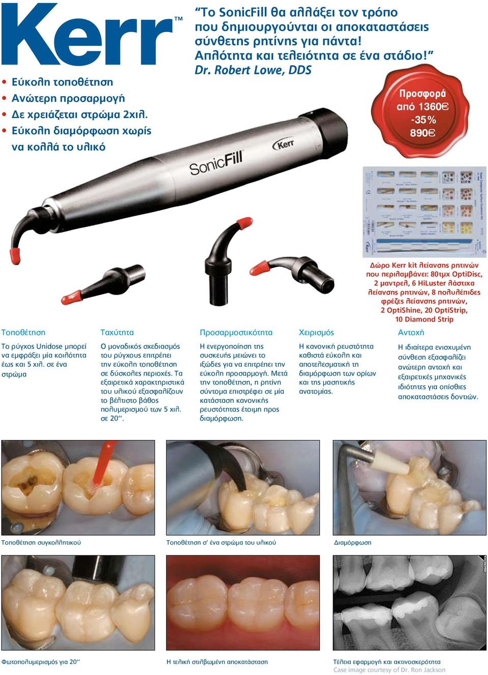 Robert Lowe, DDS από 1360-35% 890 Δώρο Kerr kit λείανσης ρητινών που περιλαμβάνει: 80τμχ OptiDisc, 2 μαντρελ, 6 HiLuster λάστιχα λείανσης ρητινών, 8 πολυλέπιδες φρέζες λείανσης ρητινών, 2 OptiShine,