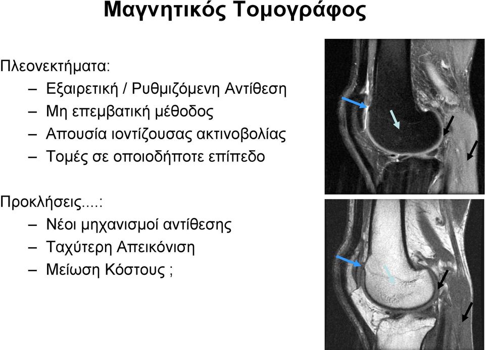 ιοντίζουσας ακτινοβολίας Τομές σε οποιοδήποτε επίπεδο